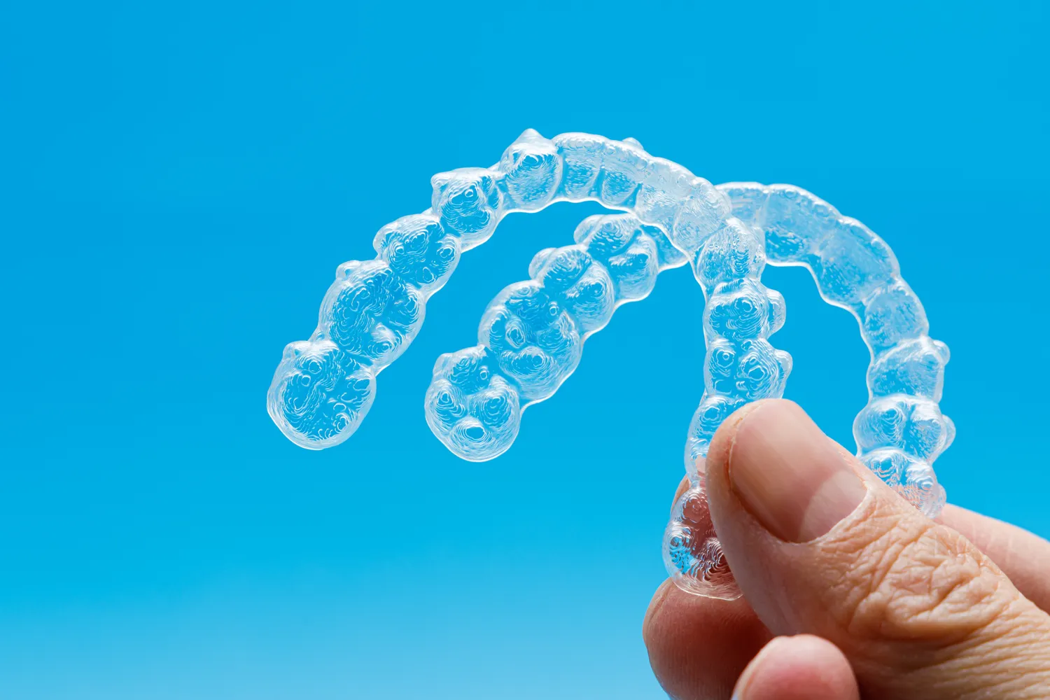 Aparat nakładkowy Invisalign Warszawa